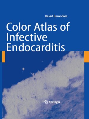 cover image of Color Atlas of Infective Endocarditis